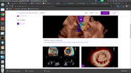 Screenshot from 2023-06-06 11-05-10.png Screenshot from 2023-06-06 11-05-10.png